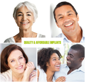 Implants – Sexton Dental Clinic